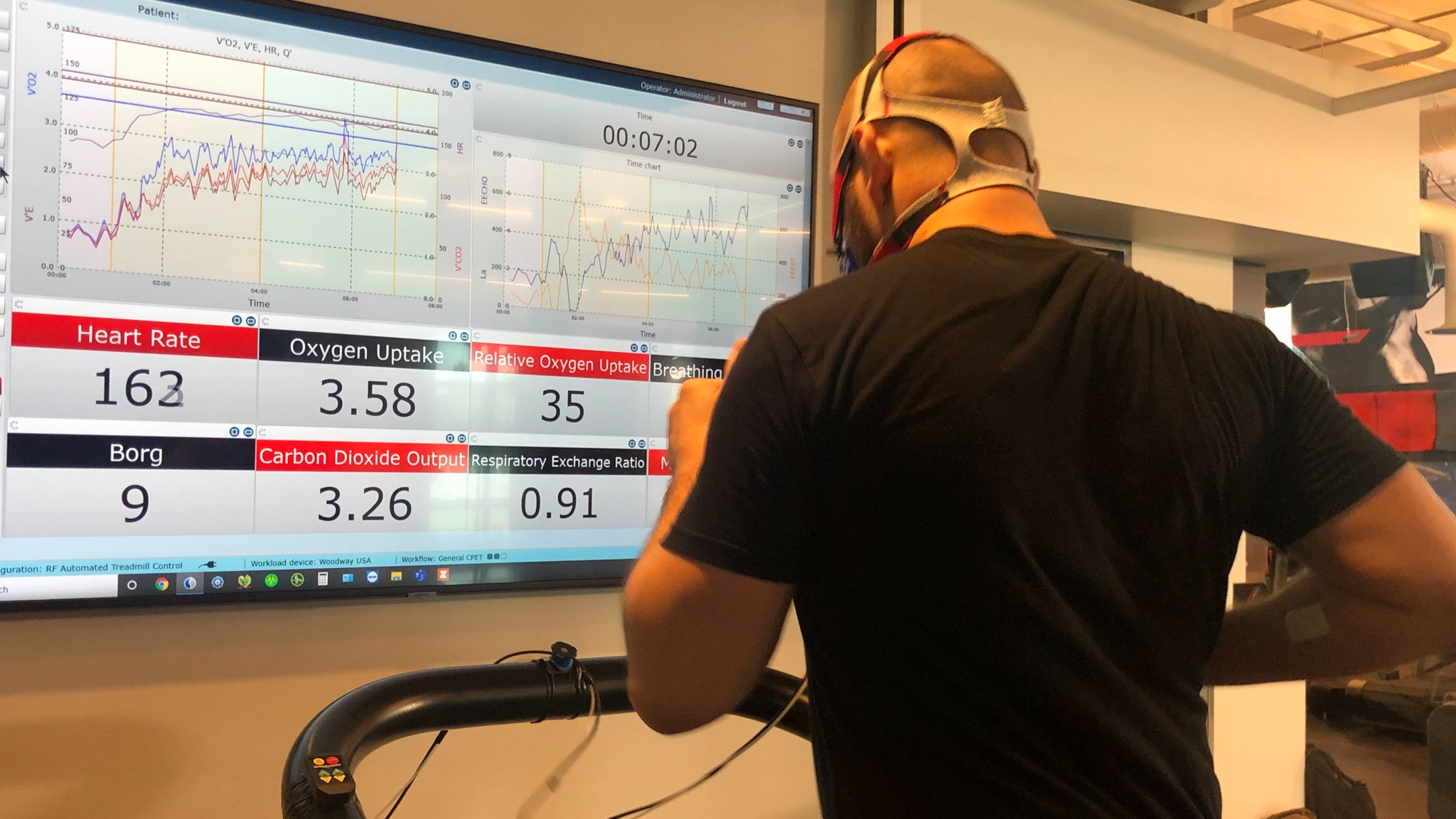 Sweat Test 2 How Hydration Testing Improves Performance