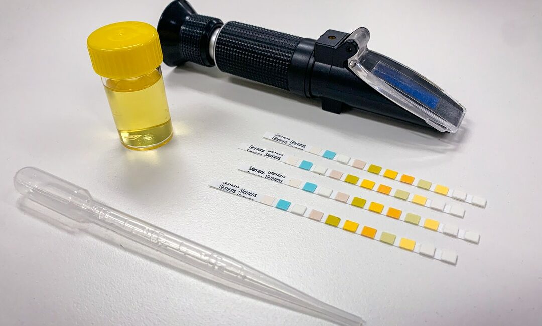 Saliva Osmolarity Vs Urine Specific Gravity? What Should You Pick?